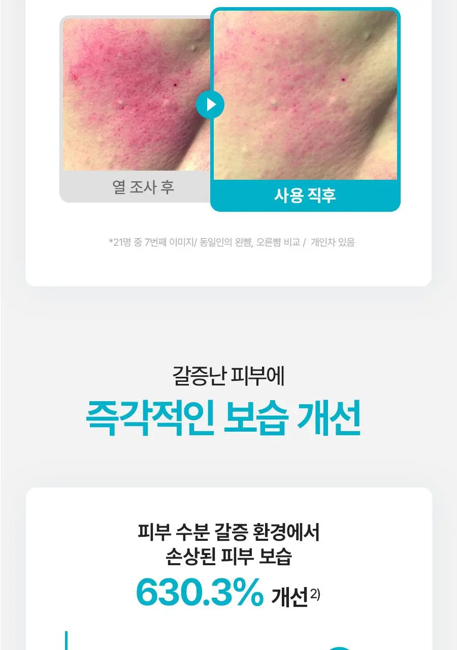 [NEW/리뷰이벤트] 비욘드 엔젤 아쿠아 이온 히알루10% 수분 진정 크림 100ml 1+1 기획 상세페이지 30